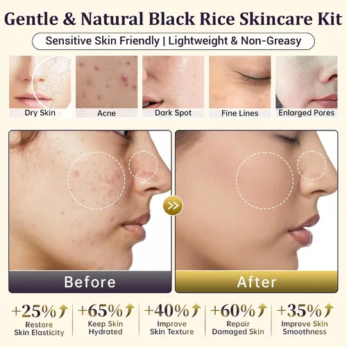 Miniatura 5 de Juego de rutina de cuidado de la piel de arroz negro natural para mujeres, kit antienvejecimiento con lavado facial, tóner, suero, loción corporal