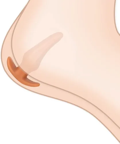 Miniatura 5 de Tapones Anales Suaves Masturbador, Tapón Anal de Silicona Líquida con Base de Seguridad Dorado Consolador Anal Dilatador Vaginal Expansor Anal