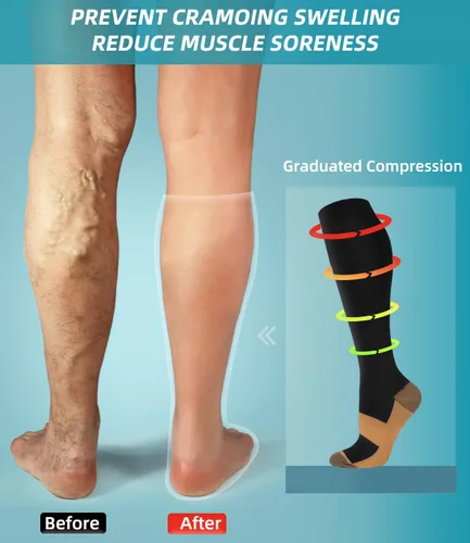 Miniatura 3 de FuelMeFoot Calcetines de compresión para mujeres y hombres, calcetines altos de apoyo graduado para enfermeras, viajes, atléticos