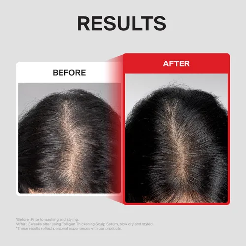 Miniatura 5 de Dr.FORHAIR Folligen - Suero espesante para el cuero cabelludo, 1.7 onzas, suero de densidad de biotina para cabello más grueso y de aspecto más