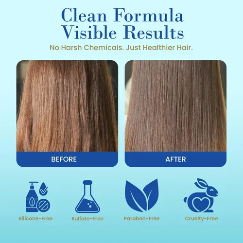 Miniatura 2 de RemeVerse Recrecimiento del cabello para adelgazar el cabello, champú, acondicionador y suero con redensyl, con vitamina C y E, hidrata el cuero