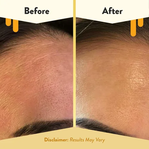 Miniatura 5 de ECZEMA HONEY Limpiador facial de avena – El lavado facial de eccema natural evita brotes – Limpiador facial suave diario para piel seca