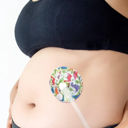 Miniatura 6 de Breling Paquete de 24 almohadillas de algodón para apoyo de alimentación, suministros de almohadillas de alimentación en forma de G para botones