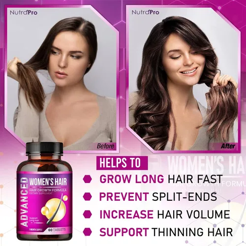 Miniatura 3 de Vitaminas para el crecimiento del cabello para mujeres – Vitaminas para el cabello adelgazante para mujeres. Suplemento para el crecimiento
