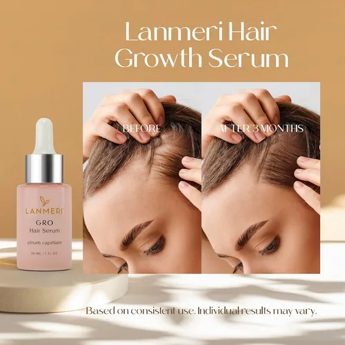Miniatura 2 de Lanmeri Suero vegano para el crecimiento del cabello, tratamientos naturales para el crecimiento del cabello y la pérdida del cabello para mujeres