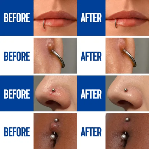 Miniatura 4 de BodyJ4You Piercing post-cuidado en aerosol – Solución salina Piercings Lavado de heridas Salina Estéril – Eliminación de golpes queloides Oído
