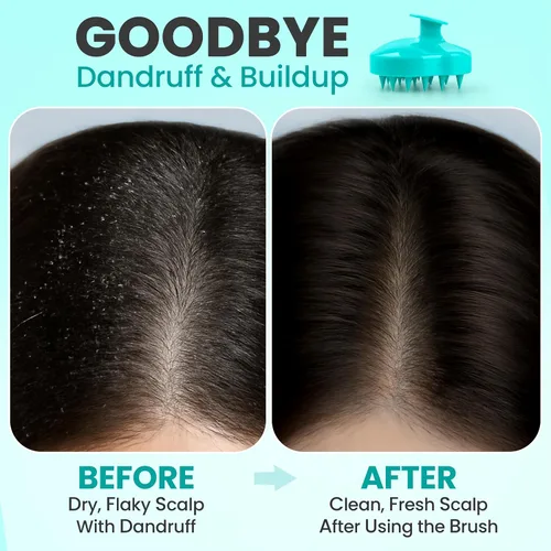 Miniatura 3 de RELAXXO Masajeador de cuero cabelludo para el crecimiento del cabello – Exfoliante y fregador de cabello para cuero cabelludo, cerdas suaves