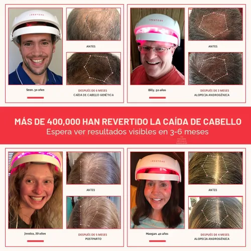 Miniatura 2 de iRestore Sistema de crecimiento del cabello con láser esencial: tratamientos de pérdida de cabello aprobados por la FDA para hombres y mujeres
