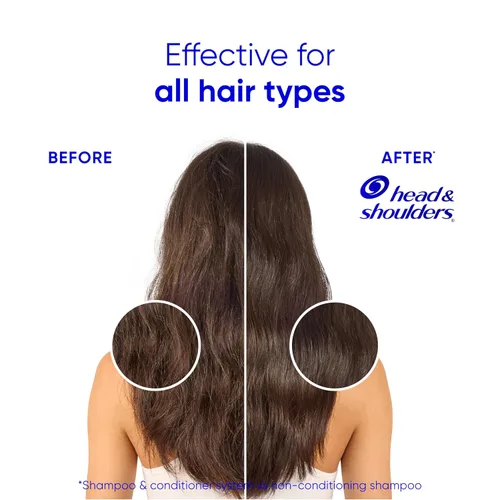 Miniatura 5 de Head & Shoulders Matt Loves Hair Favorites: Smooth & Silky 2 in 1 (28.2oz) + Bare Itchy Scalp Relief Serum (4.2oz) - Dandruff Shampoo and