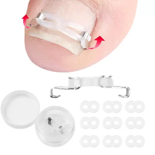 Miniatura 7 de Kit corrector de uñas encarnadas para hombres y mujeres, herramienta de uñas encarnadas, 2 clips de acero inoxidable, tiras de uñas curvas