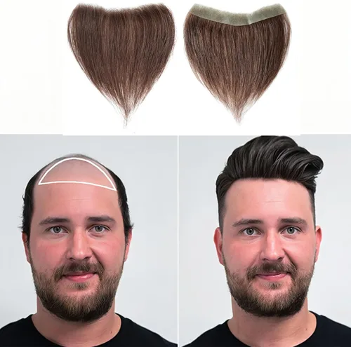 Miniatura 28 de Extensión frontal de cabello rubio claro para hombres, extensión de cabello lacio con pérdida de línea de cabello humano con cinta adhesiva