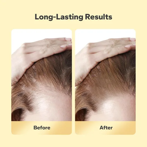 Miniatura 6 de Polvo de línea capilar – Retoque de raíz a prueba de sudor y cobertura para adelgazamiento del cabello para mujeres y hombres (Auburn)