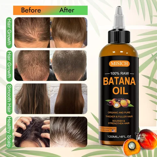 Miniatura 4 de MISICH Dr Sebi - Aceite de batana crudo, 100% natural y orgánico para el crecimiento del cabello, para hombres y mujeres, procedente de Honduras