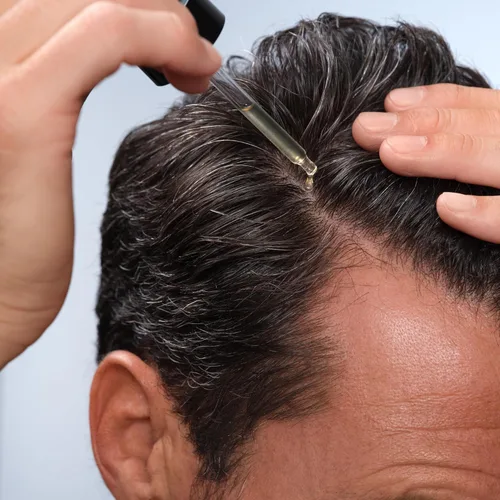 Miniatura 5 de Caldera + Lab The Hair Serum Suero espesante para hombres para adelgazar y retroceder el cabello, soporta un cabello más completo y de aspecto más