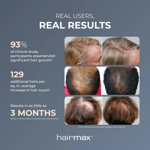 Miniatura 3 de Hairmax Ultima 12 LaserComb - (FDA Aprobado) Dispositivo de Tratamiento de Rebrotes Láser para Hombres y Mujeres - Revierte la Pérdida de Cabello