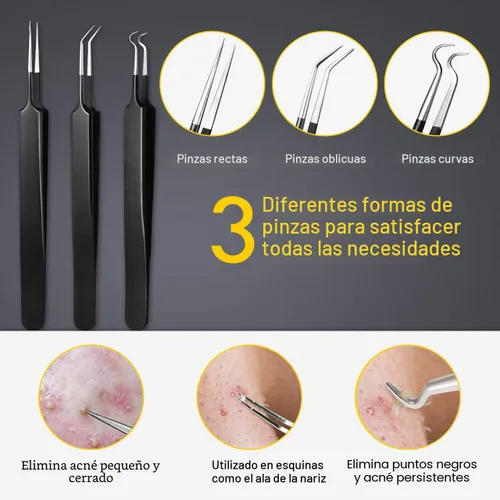 Miniatura 4 de Boxoyx - Kit de herramientas para reventar espinillas, kit de 10 piezas para eliminar puntos negros, kit extractor de comedones con caja