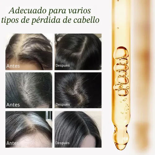 Miniatura 4 de Aceite de batana para el crecimiento del cabello, aceite natural 100% puro para el crecimiento del cabello, nutre el cuero cabelludo, elimina