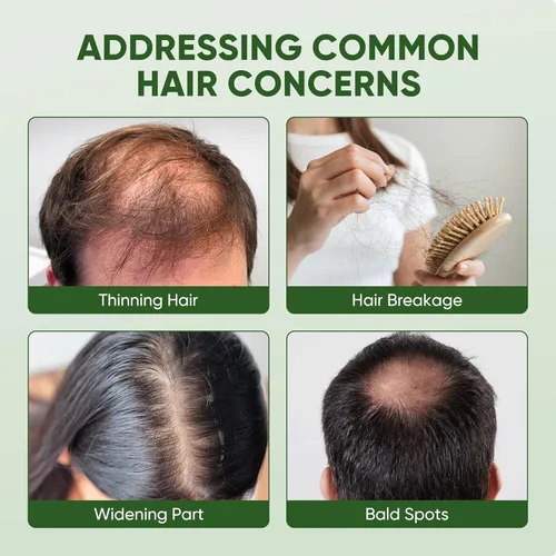 Miniatura 5 de Spray para el crecimiento del cabello con péptido de cobre: infundido con cafeína, romero y una rica mezcla de extractos vegetales nutritivos