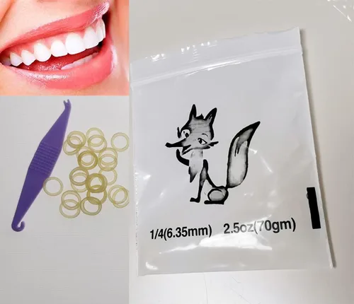 o Bandas de goma de ortodoncia, anillos de goma de 1/4 de pulgada, fuerza de luz, 2.5 onzas para frenos, bandas de goma dentales (1 bolsa)