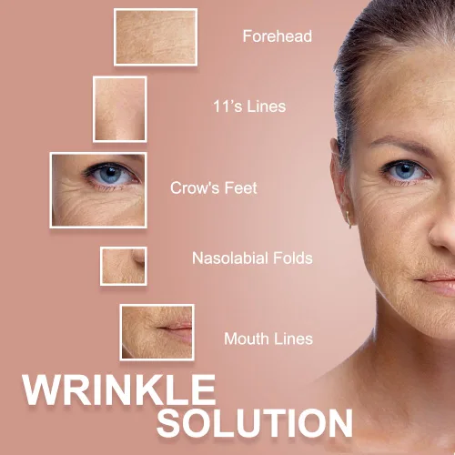 Miniatura 2 de Akissos Cinta de elevación miofascial facial Cinta de elevación facial Cintas tonificantes faciales Parches antiarrugas Adhesivos anticongelación