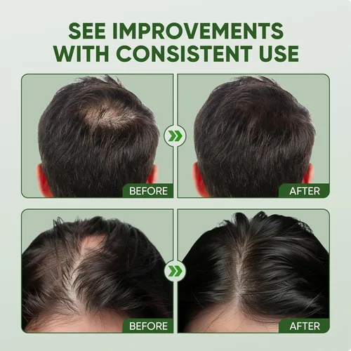 Miniatura 6 de Spray para el crecimiento del cabello con péptido de cobre: infundido con cafeína, romero y una rica mezcla de extractos vegetales nutritivos