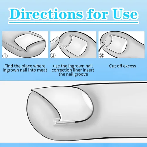 Miniatura 6 de (50+1) Juego de corrector de uñas encarnadas, kit profesional de eliminación de uñas encarnadas sin dolor con levantador de uñas de los pies, tira