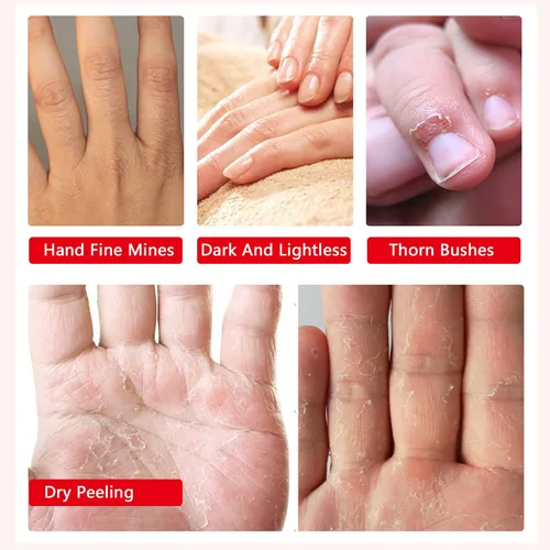 Miniatura 3 de 4 paquetes de guantes hidratantes para manos, máscara de spa para manos con colágeno, suero + vitaminas + extractos naturales de plantas para manos
