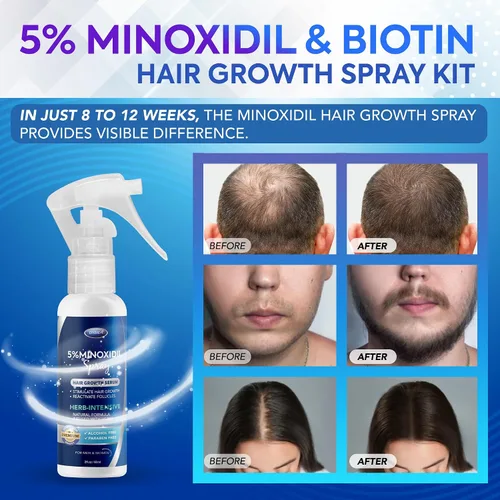 Miniatura 2 de 5% Minoxidil para hombres, espray de Minoxidil, Minoxidil para el crecimiento del cabello en mujeres, Minoxidil para el crecimiento de la barba