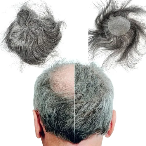 Miniatura 9 de Voloria Parche para el cabello calvo para hombres, 3.15 x 3.15 pulgadas, sistema de reemplazo de cobertura completa de piel de poliuretano