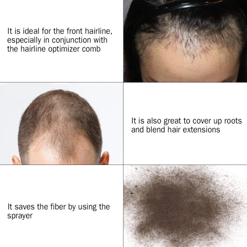 Miniatura 2 de Aplicador de fibra capilar, boquilla pulverizadora de fibra capilar, herramientas para engrosar el cabello, hombres y mujeres para boquilla