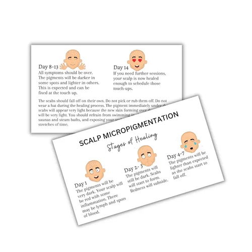 Tarjetas de cuidados posteriores a las etapas de micropigmentación del cuero cabelludo | Paquete de 50 tarjetas de 2 x 3.5 pulgadas | Microblading