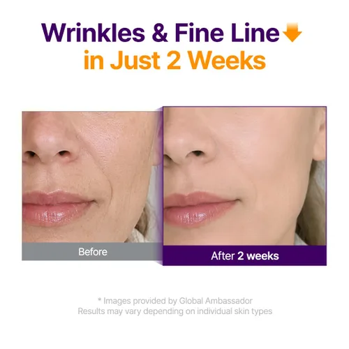 Miniatura 5 de PURITO Retinol 0.1% + Retinal 0.1% Suero facial antienvejecimiento para arrugas, líneas finas y piel más firme Retinoides duales con NAD+