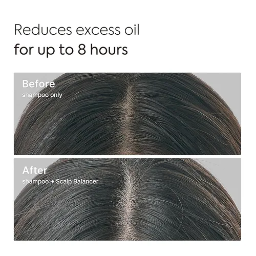 Miniatura 4 de Apple Zinc Scalp Balancer - Suero de raíz, control del cuero cabelludo graso y con picazón con 1% de zinc PCA y manzana prosesionada en frío, suero