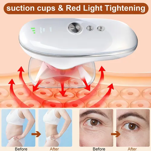 Miniatura 4 de 5-in-1 Electric Body Sculpting Massager - Red Blue LED Light Therapy & Microcurrent Tool with Oval/Round Suction Cups for Face & Body Tightening