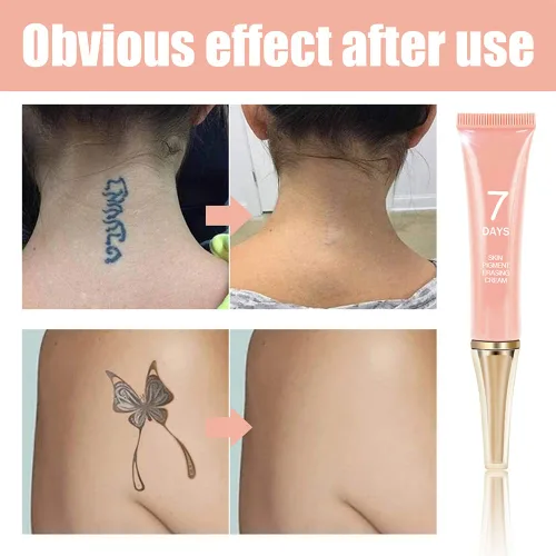 Miniatura 3 de Crema de eliminación de tatuajes que funciona rápido, crema permanente para eliminar tatuajes, cremas de borrado de pigmentos de la piel, tatuajes