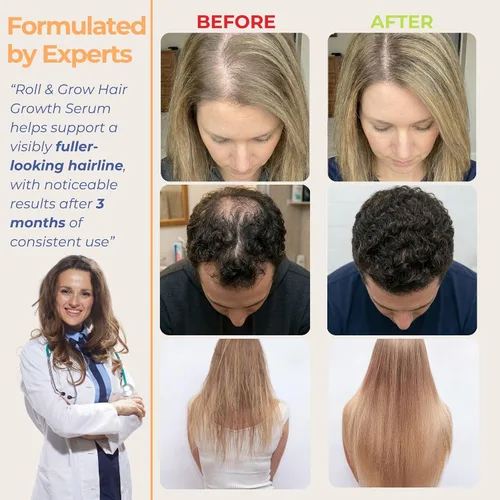 Miniatura 5 de Suero Roll-On para el crecimiento del cabello – 5% romero, 3% proteína y 2% cafeína – Aceite de batana y biotina para el cuero cabelludo
