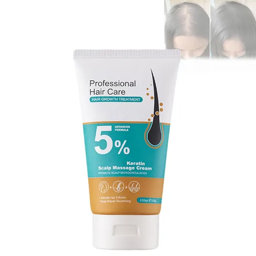 Crema de masaje de cuero cabelludo de minoxidil al 5 % para el crecimiento del cabello, crema de minoxidil profesional, rápido crecimiento y