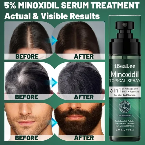 Miniatura 5 de 5% Minoxidil for Men & Women - Minoxidil Spray for Hair Growth with Biotin & Rosemary, Topical Treatment for Thinning Hair, Beard & Scalp, Extra