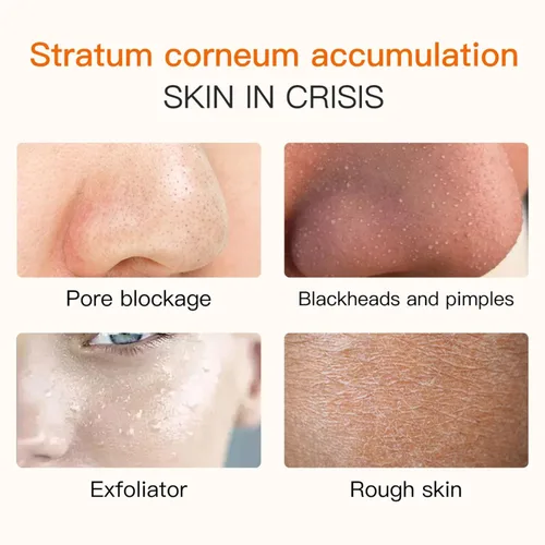 Miniatura 6 de Gel exfoliante naranja para cara y cuerpo - Exfoliante enzimático suave con extracto de naranja natural, exfoliante facial hidratante para todo tipo