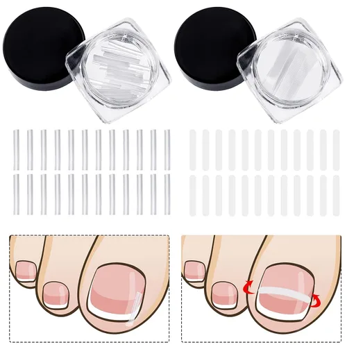 60 tiras correctoras de uñas encarnadas, corrección de uñas encarnadas, corrección de uñas, clip para enderezar uñas, parche curvo corrector de uñas