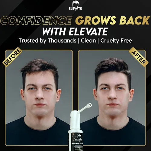 Miniatura 5 de Elevate Tratamiento de crecimiento del cabello 5% Minoxidil Spray para hombres – Fórmula clínicamente probada de rápida absorción para pérdida