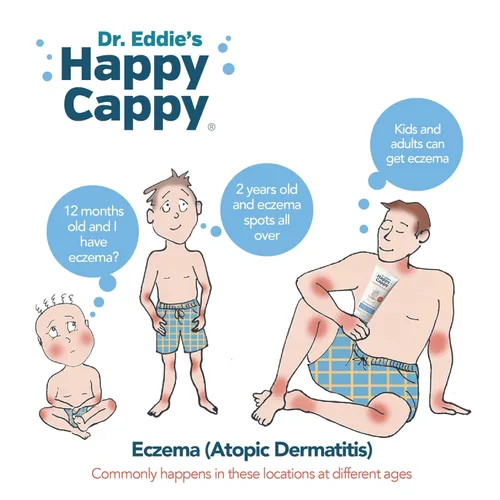 Miniatura 6 de Happy Cappy Champú y Jabón Corporal para Bebés - Jabón Corporal para Eczema para Niños y Pequeños, Ayuda con la Sequedad, Reduce la Comezón
