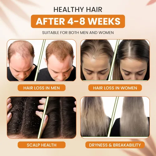 Miniatura 8 de Aceite de batana crudo para el crecimiento del cabello, 100% puro y sin refinar de Honduras, aceite orgánico para el cabello para prevenir
