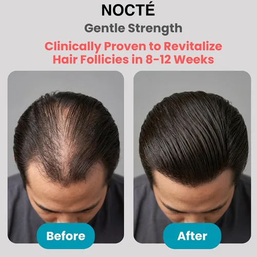 Miniatura 4 de Spray de suero para el crecimiento del cabello – Minoxidil 2% biotina avanzada con cafeína, romero, extracto botánico para cabello más grueso, más