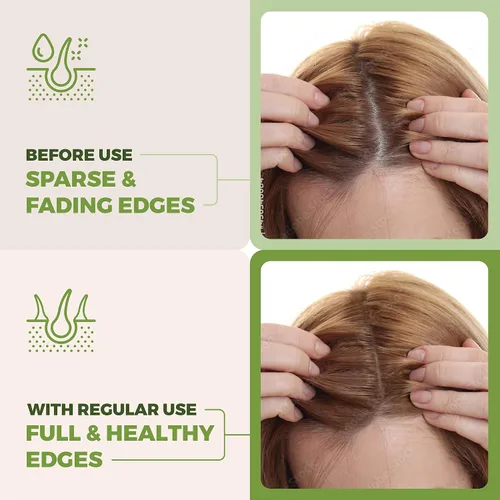 Miniatura 6 de Aceite de batana prémium para el crecimiento del cabello, 100% Batana natural de Honduras, aceite de ricino y romero para estimular el crecimiento