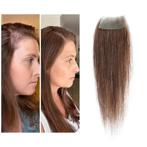 Miniatura 42 de Reemplazo de cabello humano con cicatrices, quemaduras accidentales sin vello para hombres y mujeres, pérdida de línea de cabello, cinta recta