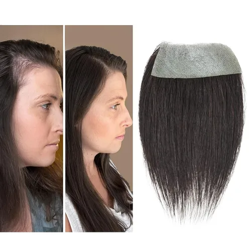 Miniatura 11 de Reemplazo de cabello humano con cicatrices, quemaduras accidentales sin vello para hombres y mujeres, pérdida de línea de cabello, cinta recta