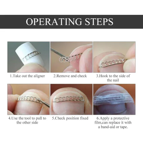 Miniatura 7 de Corrector de uñas pedicura herramienta de cuidado de pies, 12 unids/caja de herramienta de corrección de uñas de los pies, 6 tamaños encarnados