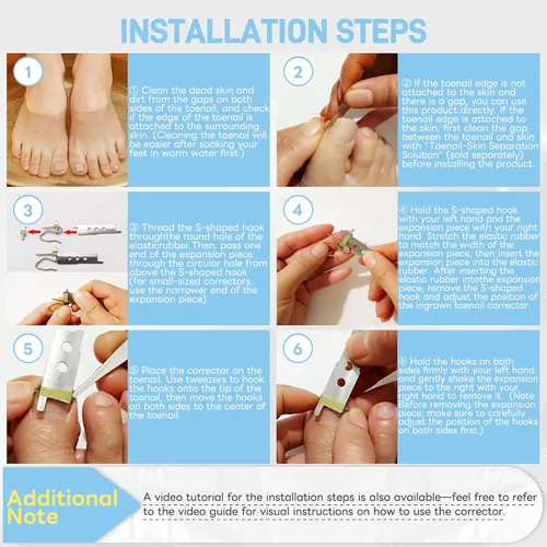 Miniatura 5 de InhwRior Corrector de uñas encarnadas, fácil aplicación en casa, ajuste seguro (sin deslizamiento), tracción constante para alivio rápido del dolor