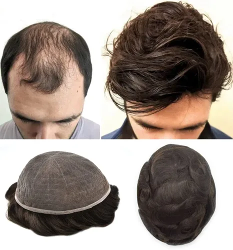 Miniatura 39 de Extensiones de cabello suizo completo para hombre, sistema de reemplazo de cabello humano europeo para hombres